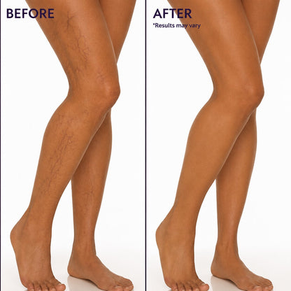 Body Coverage Perfector